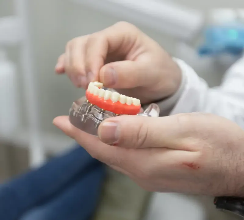 Dental Implant Cost