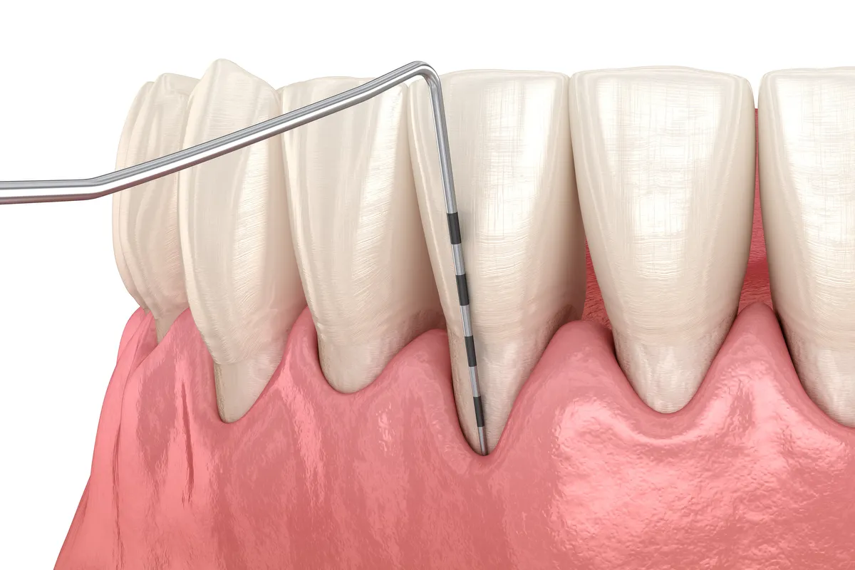 periodontics 02